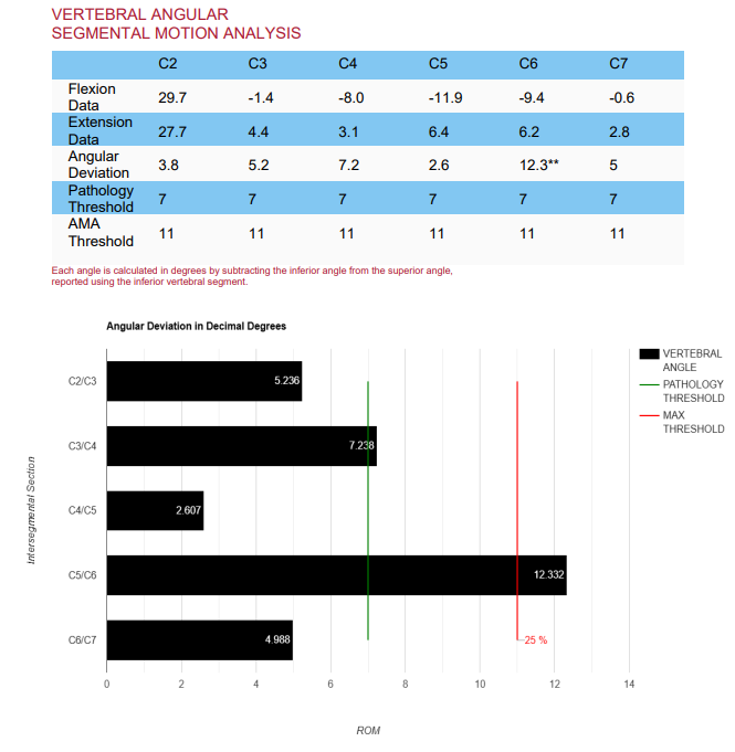 AOMSI vertebral angular segmental motion analysis report — Optimum Chiropractic Care Mobile AL